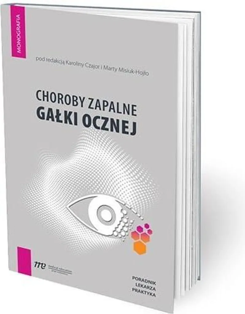 Livre Choroby zapalne gałki ocznej : Guide médical sur l'inflammation