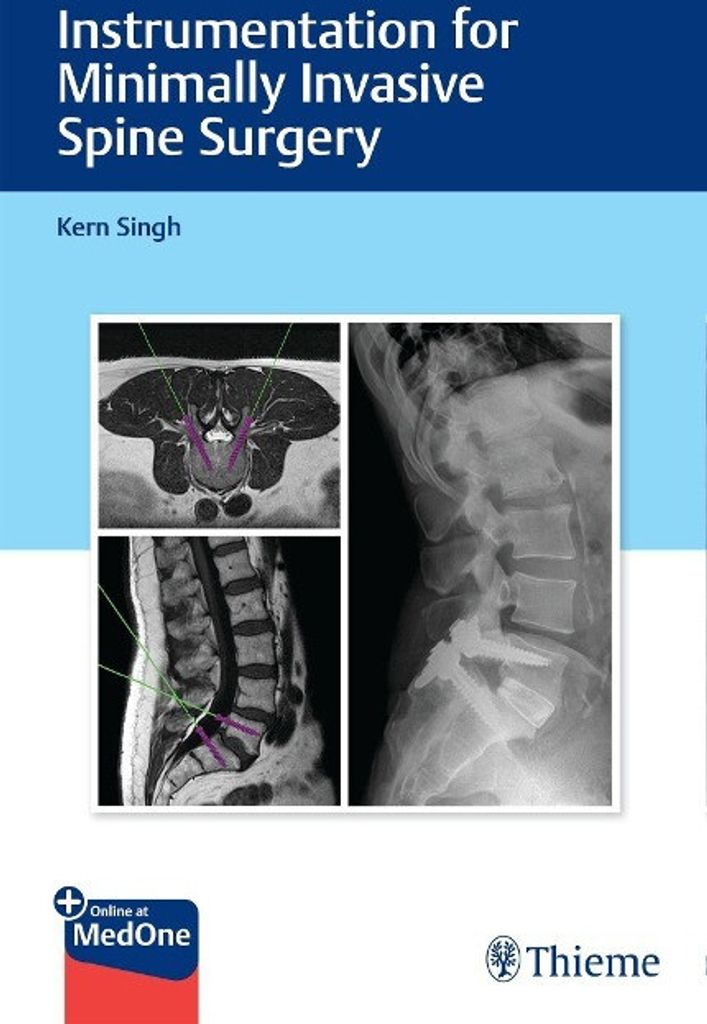 Instrumentation for Minimally Invasive Spine Surgery