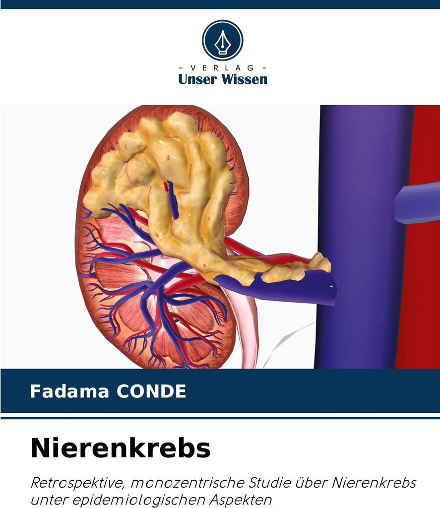 Nierenkrebs