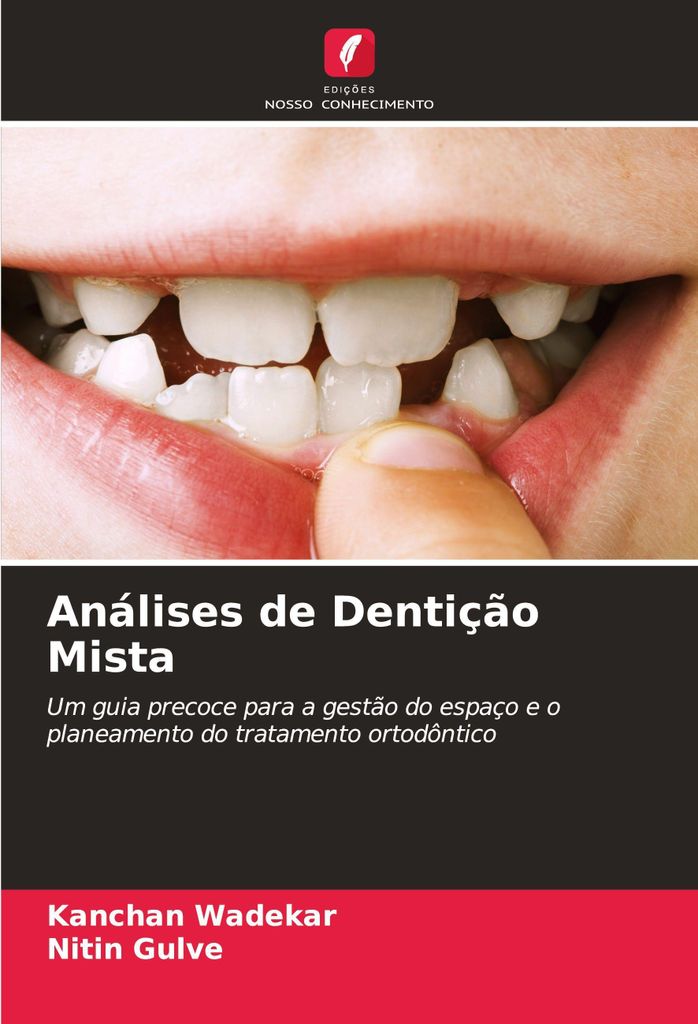 Análises de Dentição Mista