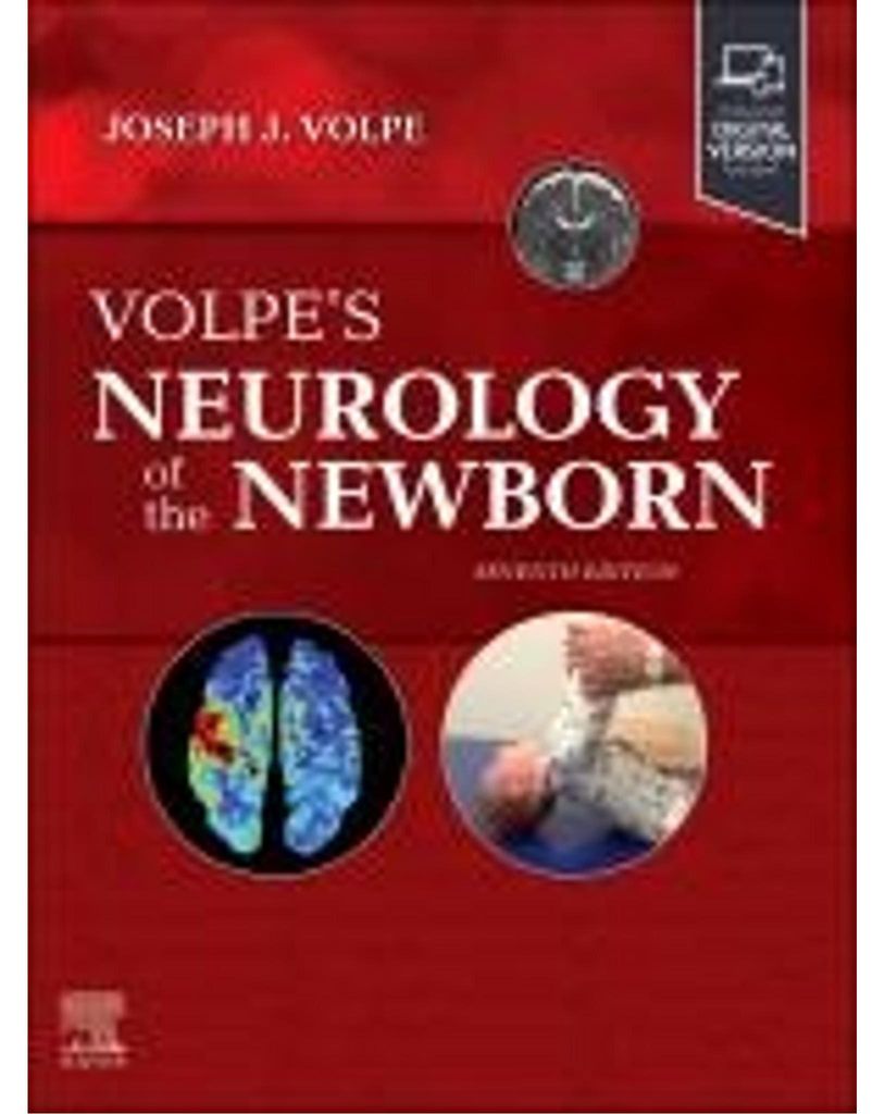 Volpe's Neurology of the Newborn