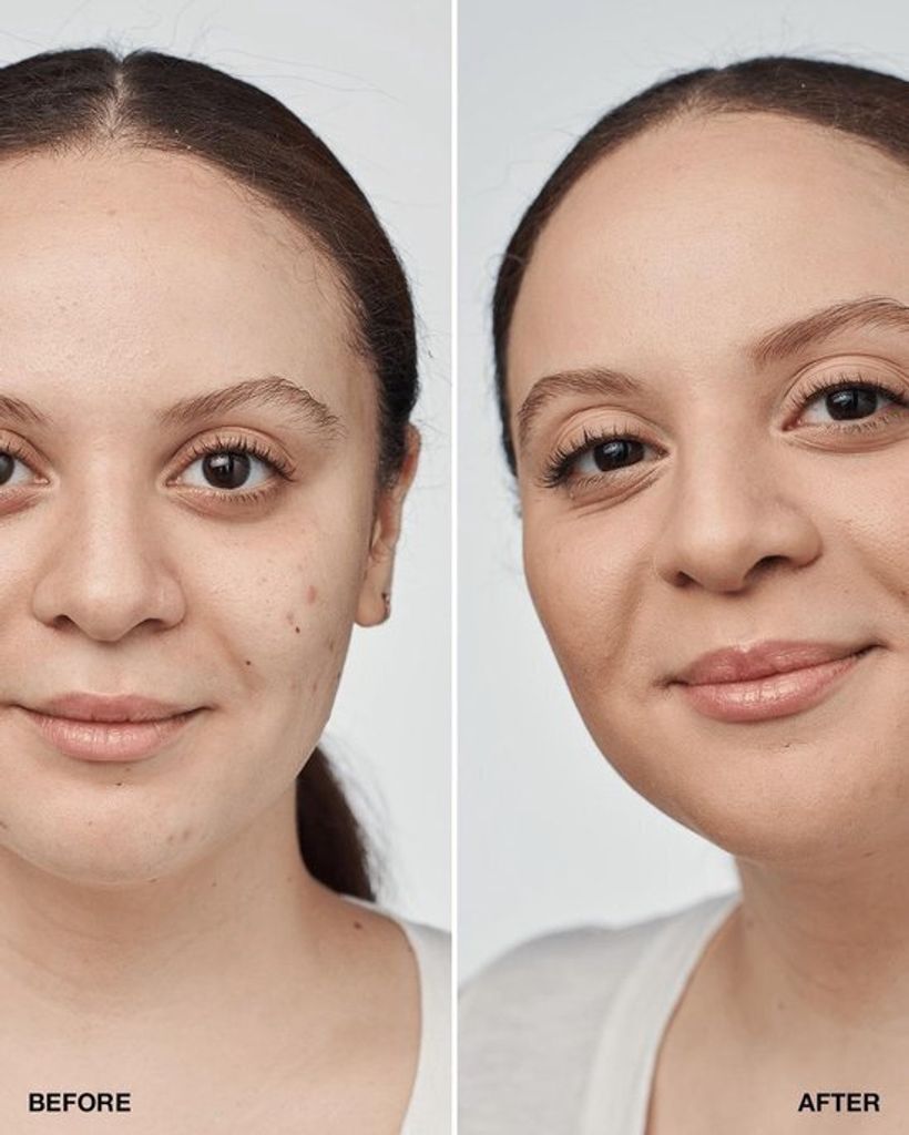 Clinique Even Better Serum Foundation Spf20 CN52 Neutral 30ml