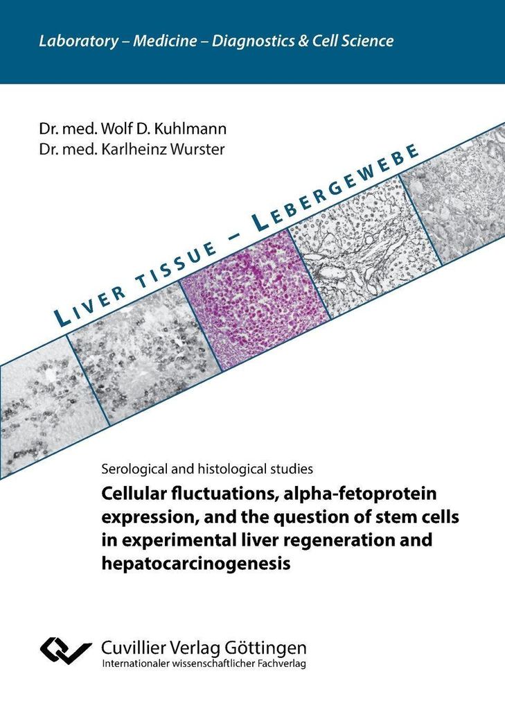 Cellular fluctuations, alpha-fetoprotein expression, and the question of stem cells in experimental liver regeneration and hepatocarcinogenesis