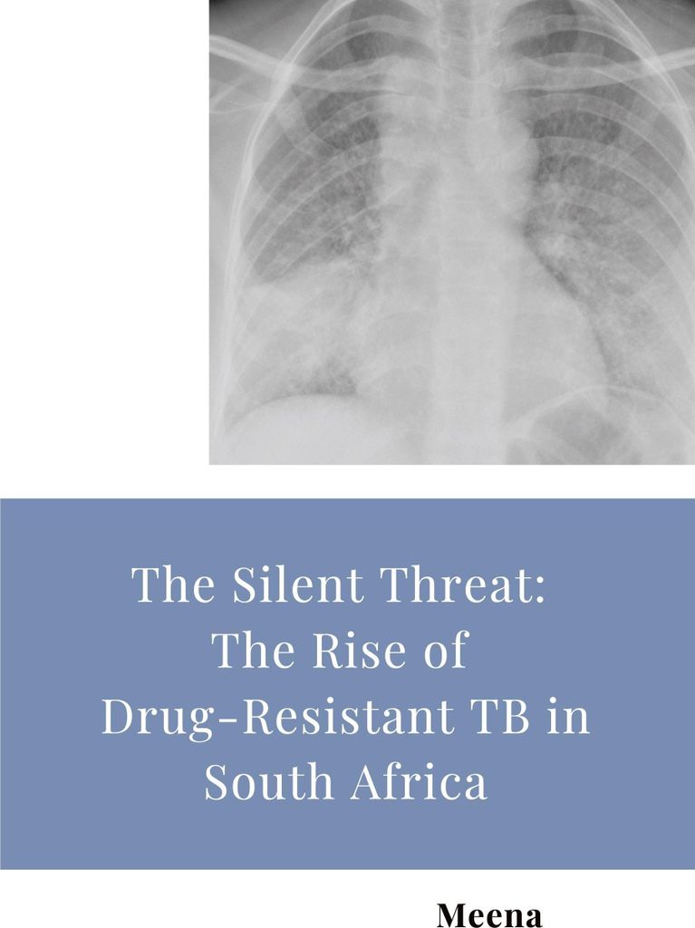 The Silent Threat: The Rise of Drug-Resistant TB in South Africa