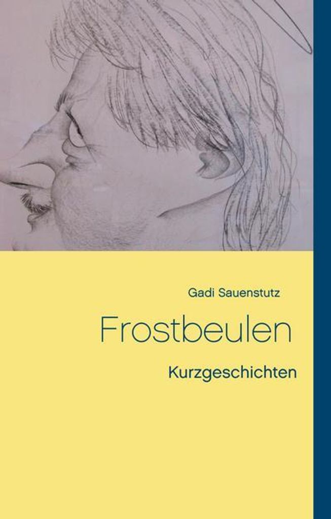 Frostbeulen