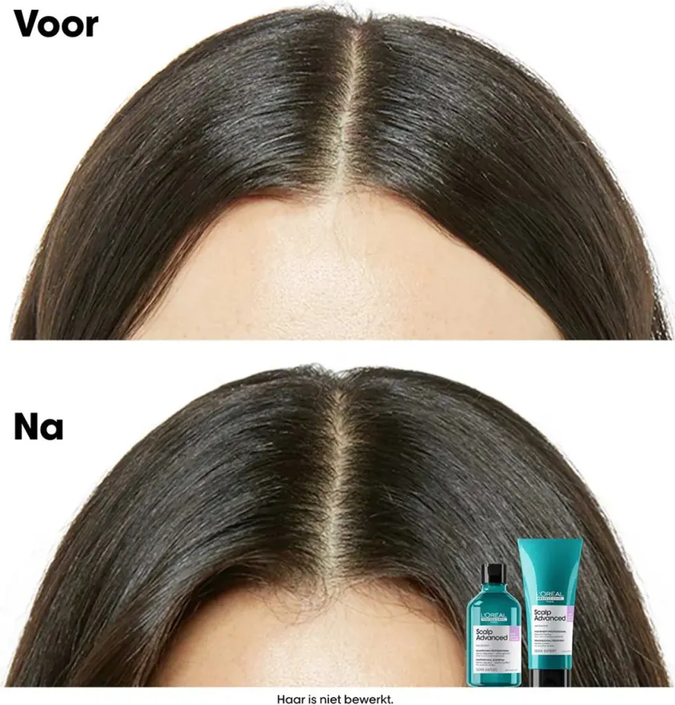 L'Oréal Serie Expert Scalp Advanced 500ml: Spa per la tua Cute - 4