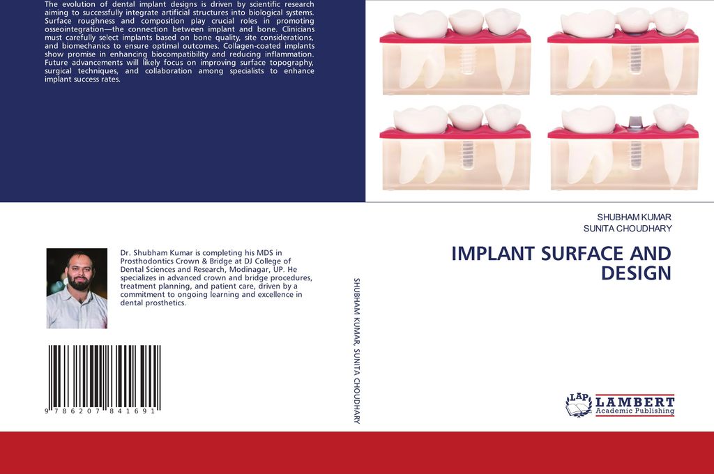 Implant Surface And Design