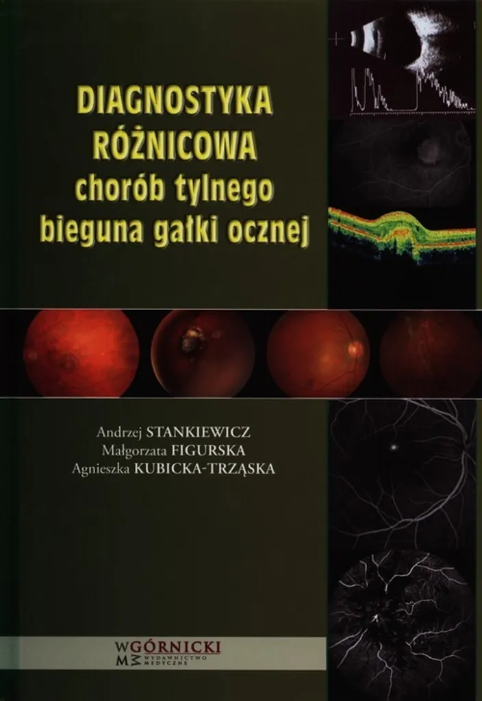 Livre de diagnostic différentiel des maladies du pôle postérieur oculaire