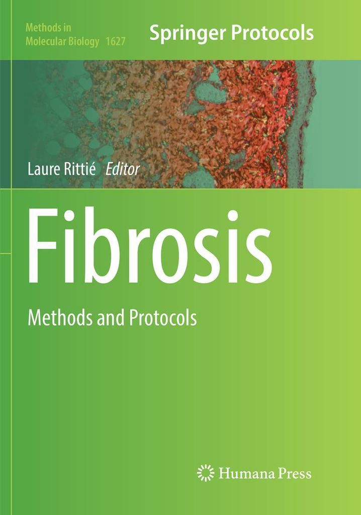Fibrosis