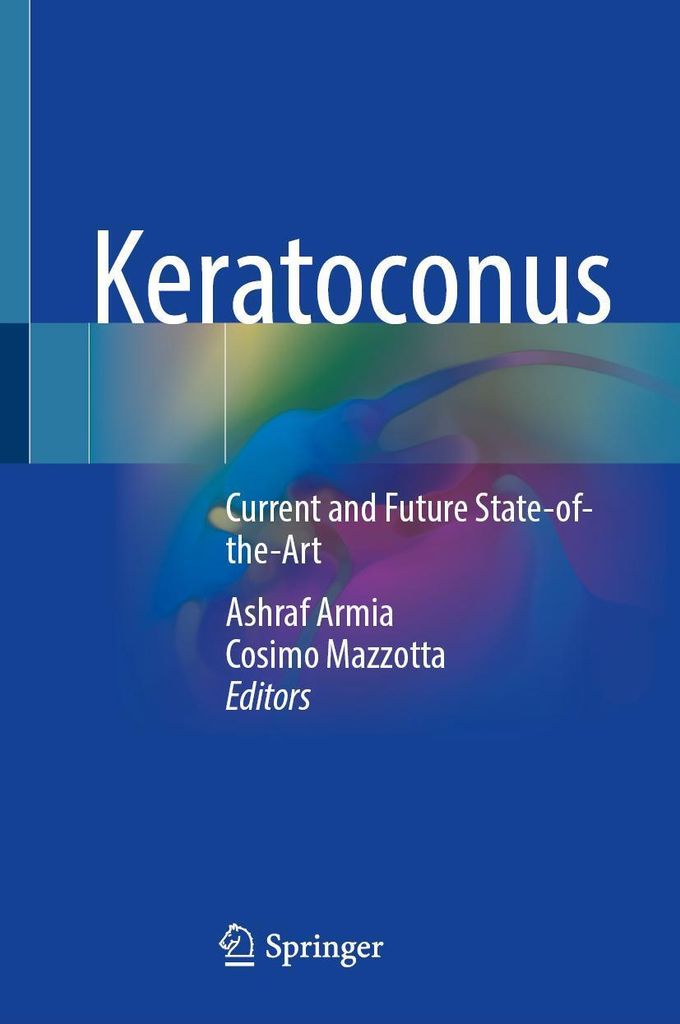 Keratokonus