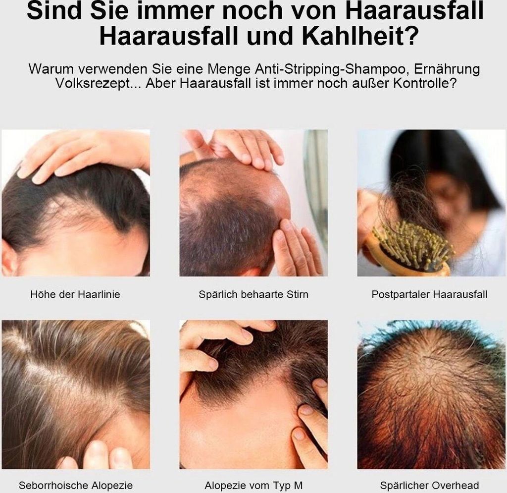 Schuppenkamm Mit Reinigungsfunktion – Rot, Selbstreinigend, Für Kopfhautmassage