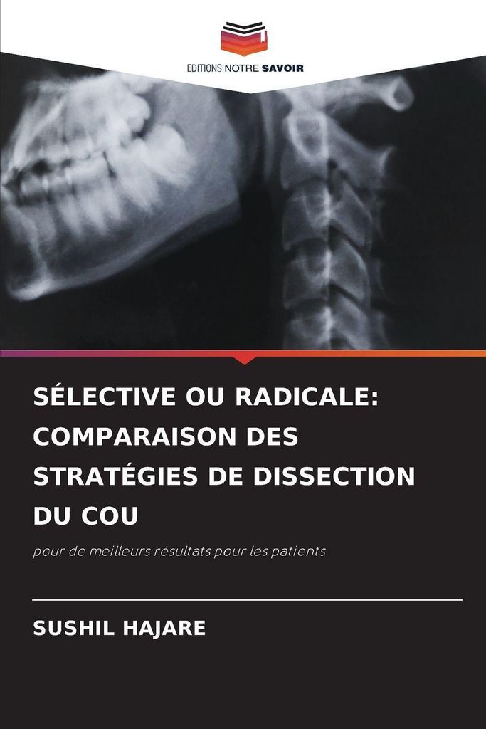 Sélective Ou Radicale: Comparaison Des Stratégies De Dissection Du Cou