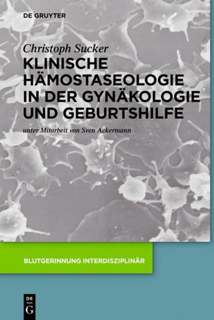 Klinische Hämostaseologie in der Gynäkologie und Geburtshilfe