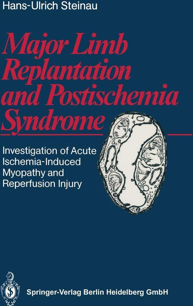 Major Limb Replantation and Postischemia Syndrome