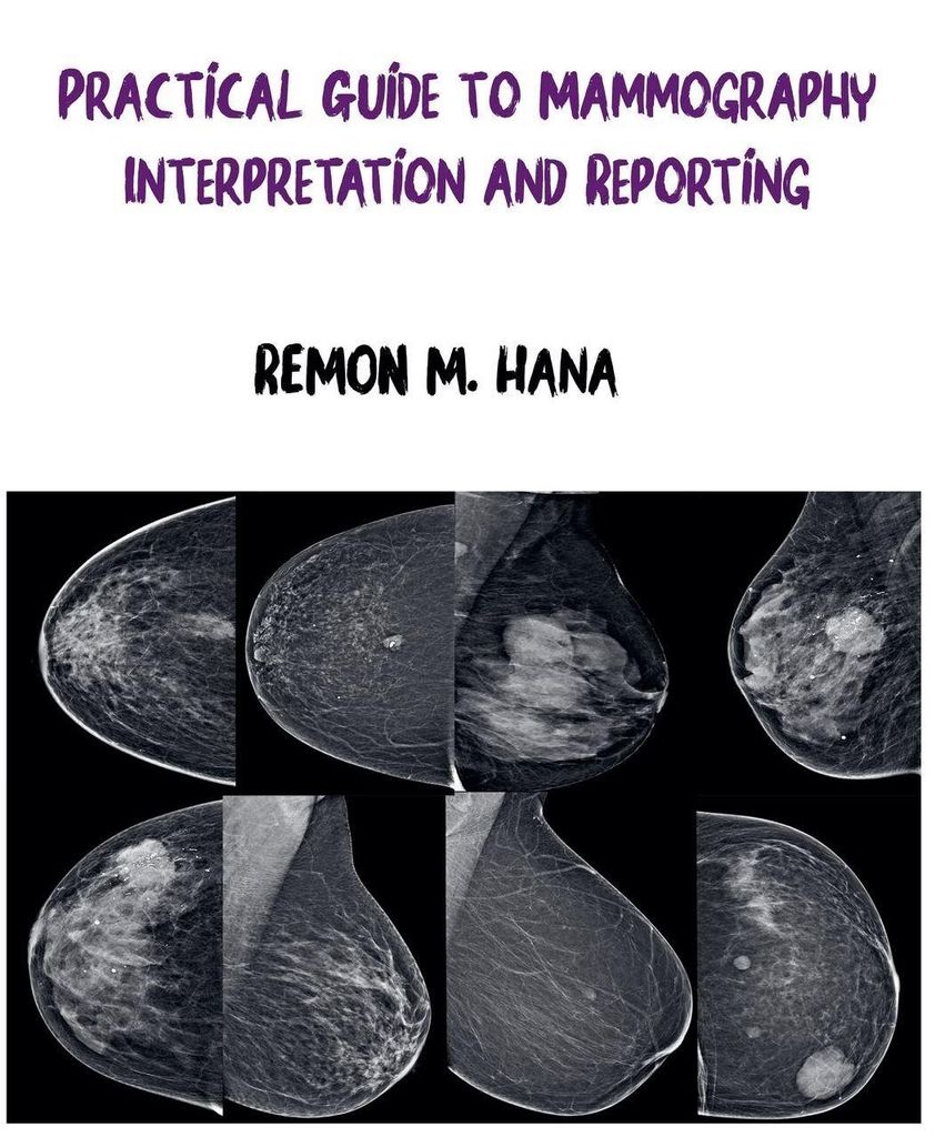 Practical Guide to Mammography Interpretation and Reporting