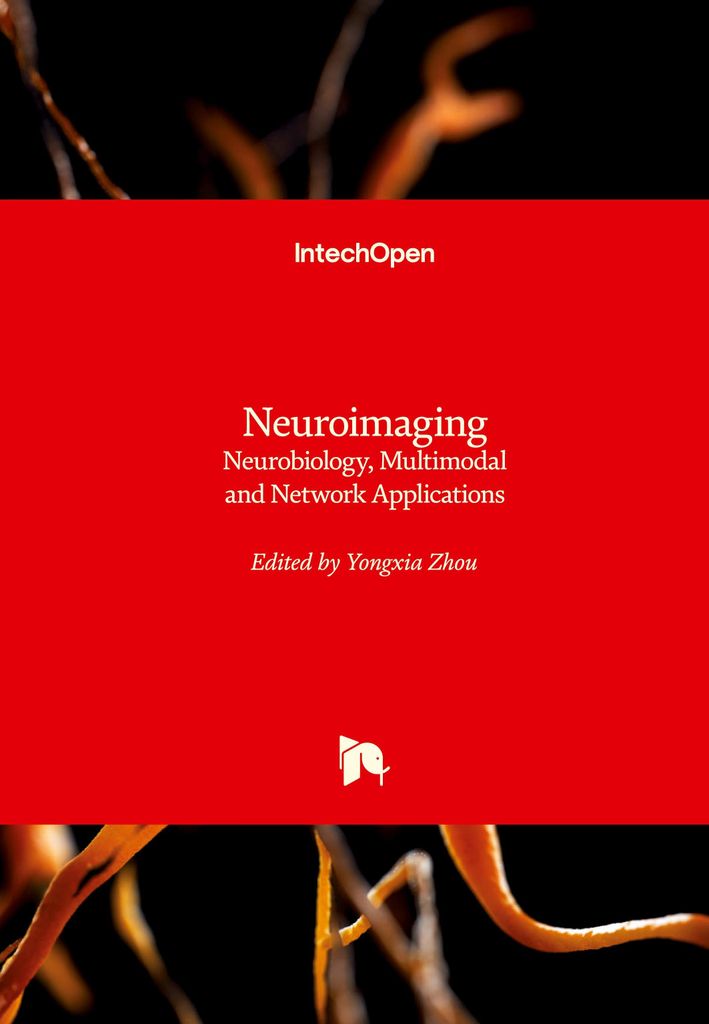 Neuroimaging