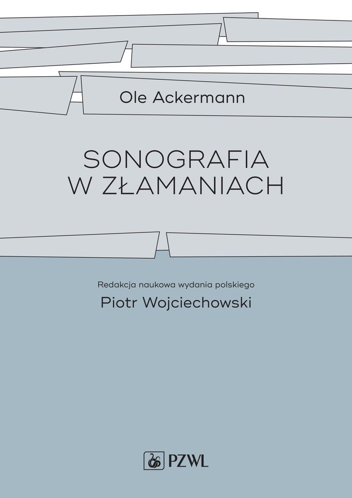 Sonographie bei Frakturen