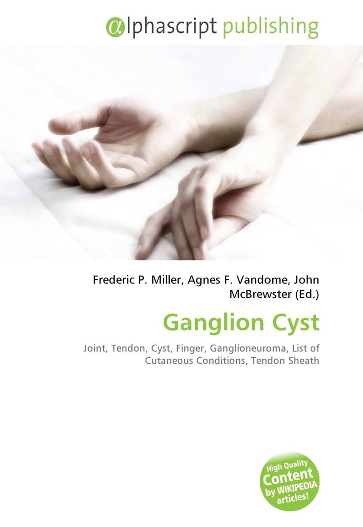Ganglion Cyst