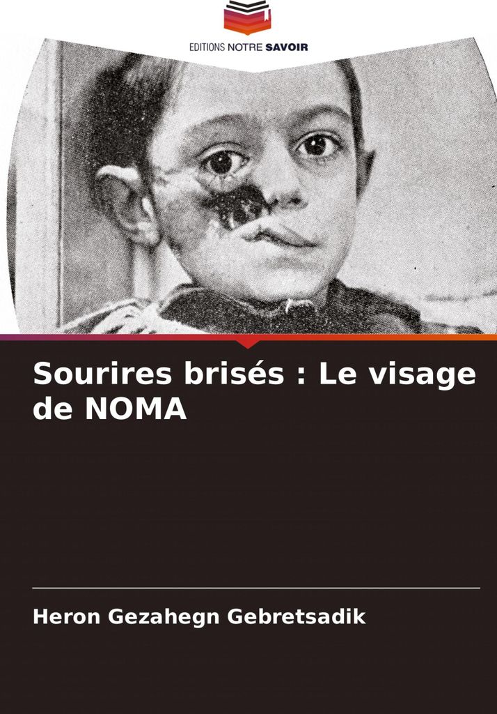 Sourires brisés : Le visage de NOMA