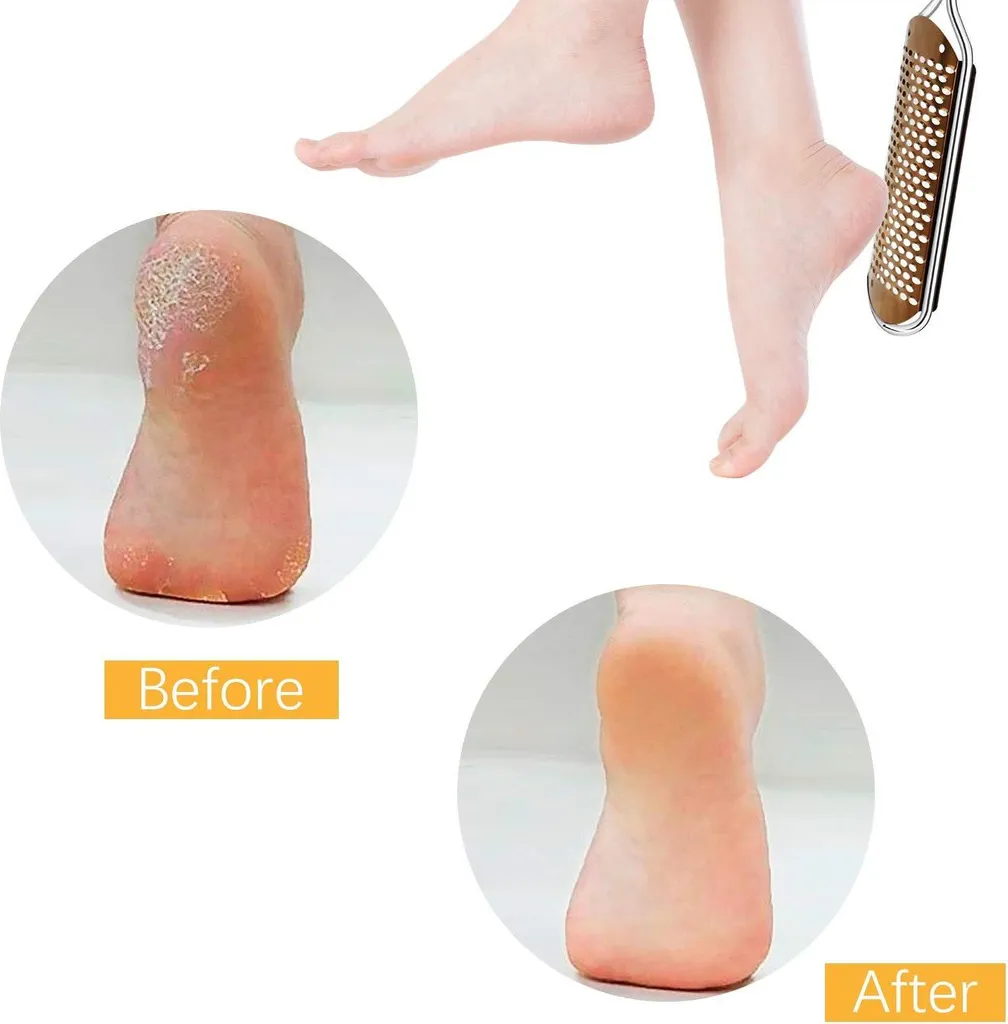 Lime à callosité acier inoxydable double usage pieds lisses et doux