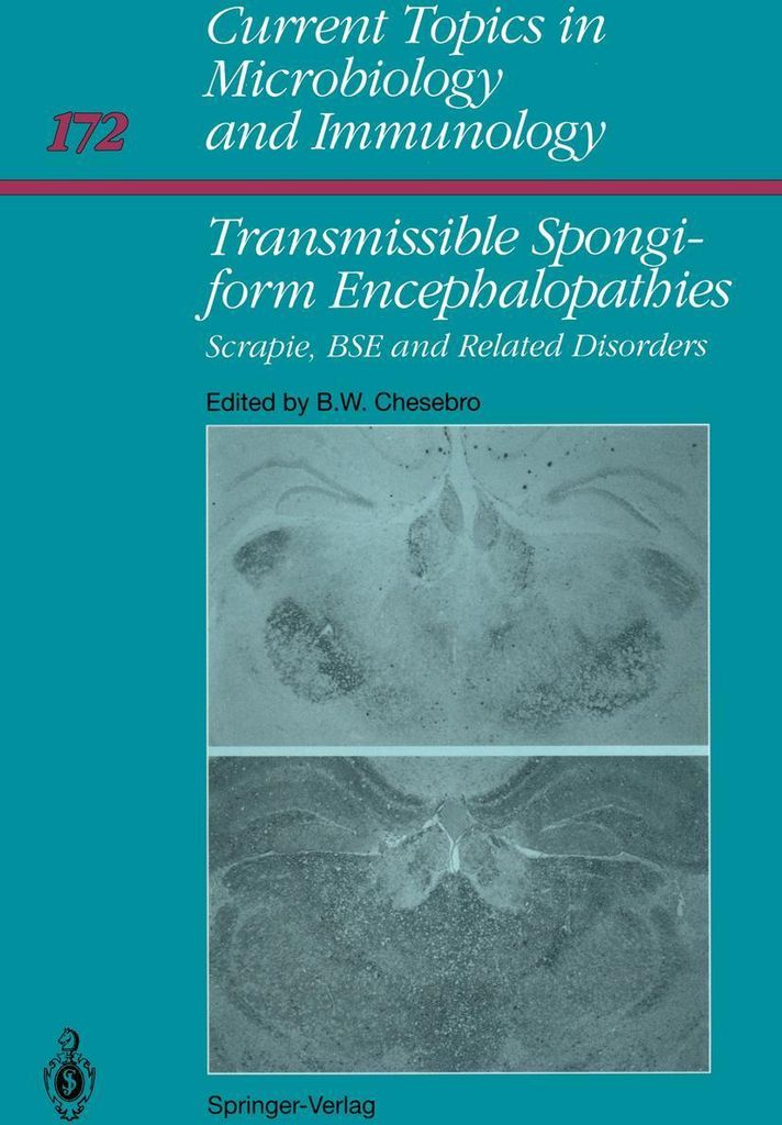 Transmissible Spongiform Encephalopathies: