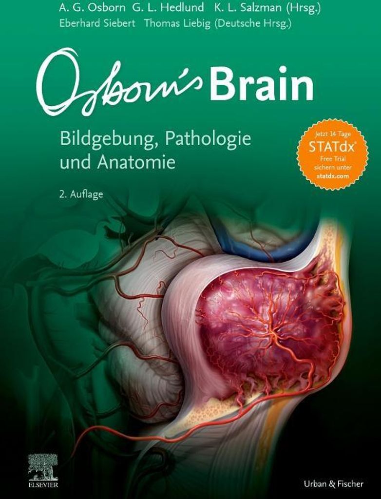 Osborn's Brain