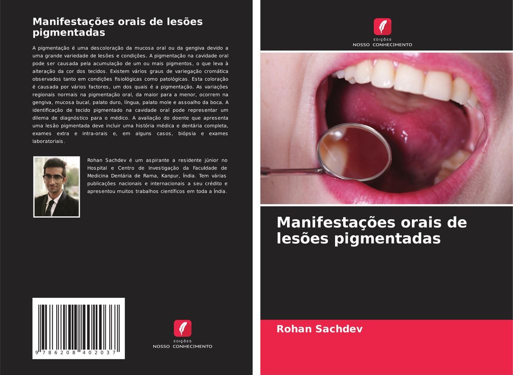 Manifestações orais de lesões pigmentadas