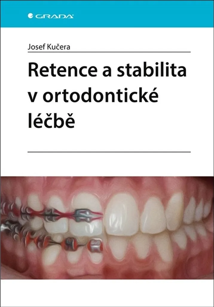 Guide pour réussir la rétention en orthodontie par le Dr Kučera