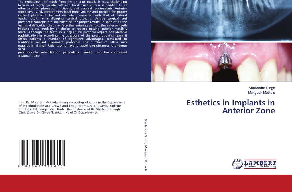 Esthetics in Implants in Anterior Zone