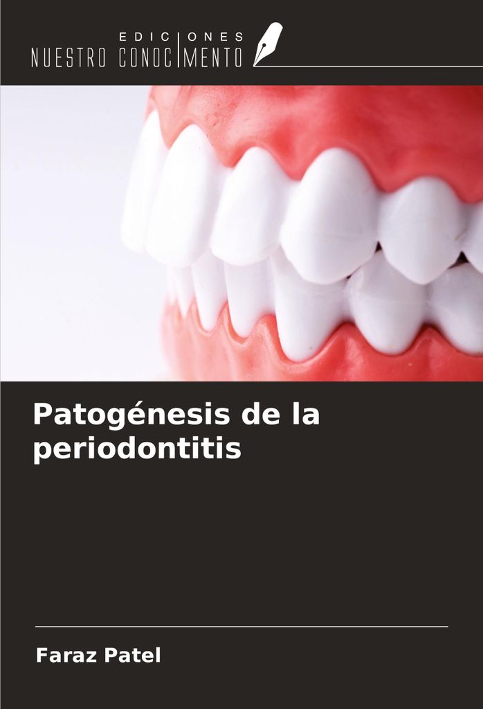 Patogénesis de la periodontitis