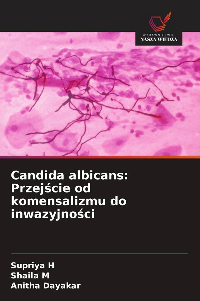 Candida albicans: Przej¿cie od komensalizmu do inwazyjno¿ci