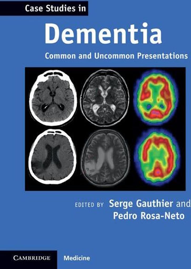 Case Studies in Dementia: Common And Uncommon Presentations (Case Studies in Neurology)