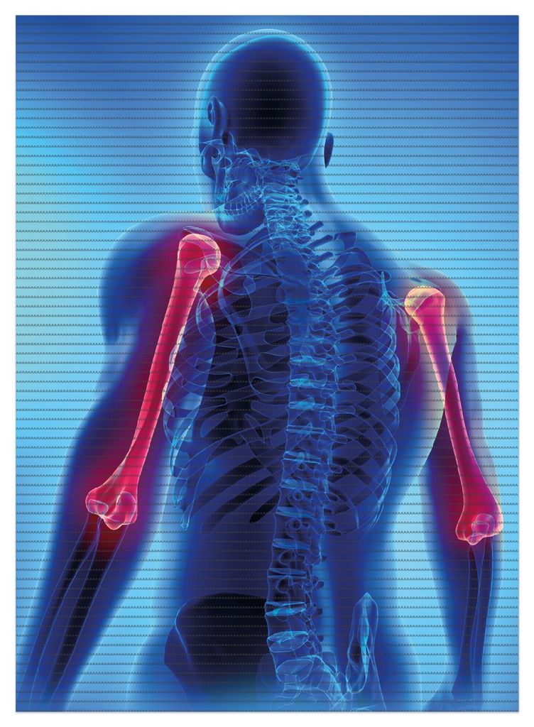 Wallario Duschmatte Antirutschmatte Badmatte Fußmatte Anatomie Mensch Oberarmknochen, Größe ca. 90 x 65 cm
