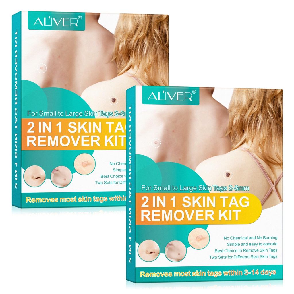 Stielwarzen Entferner Skin Tag Removal Set Anti Stielwarze Produktbild 
