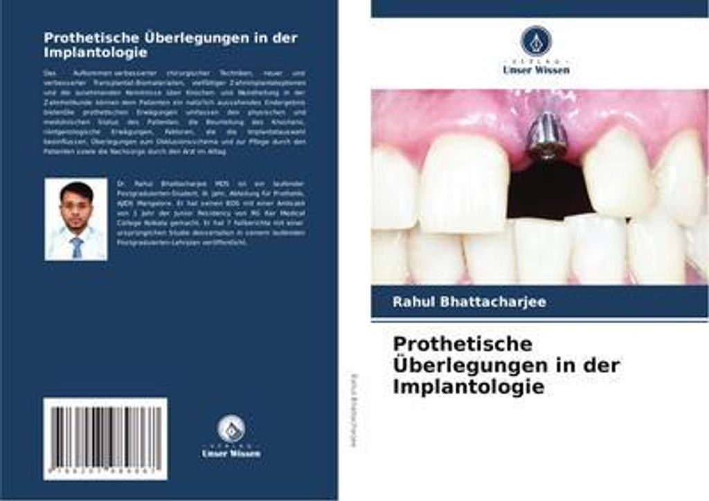 Prothetische Überlegungen in der Implantologie