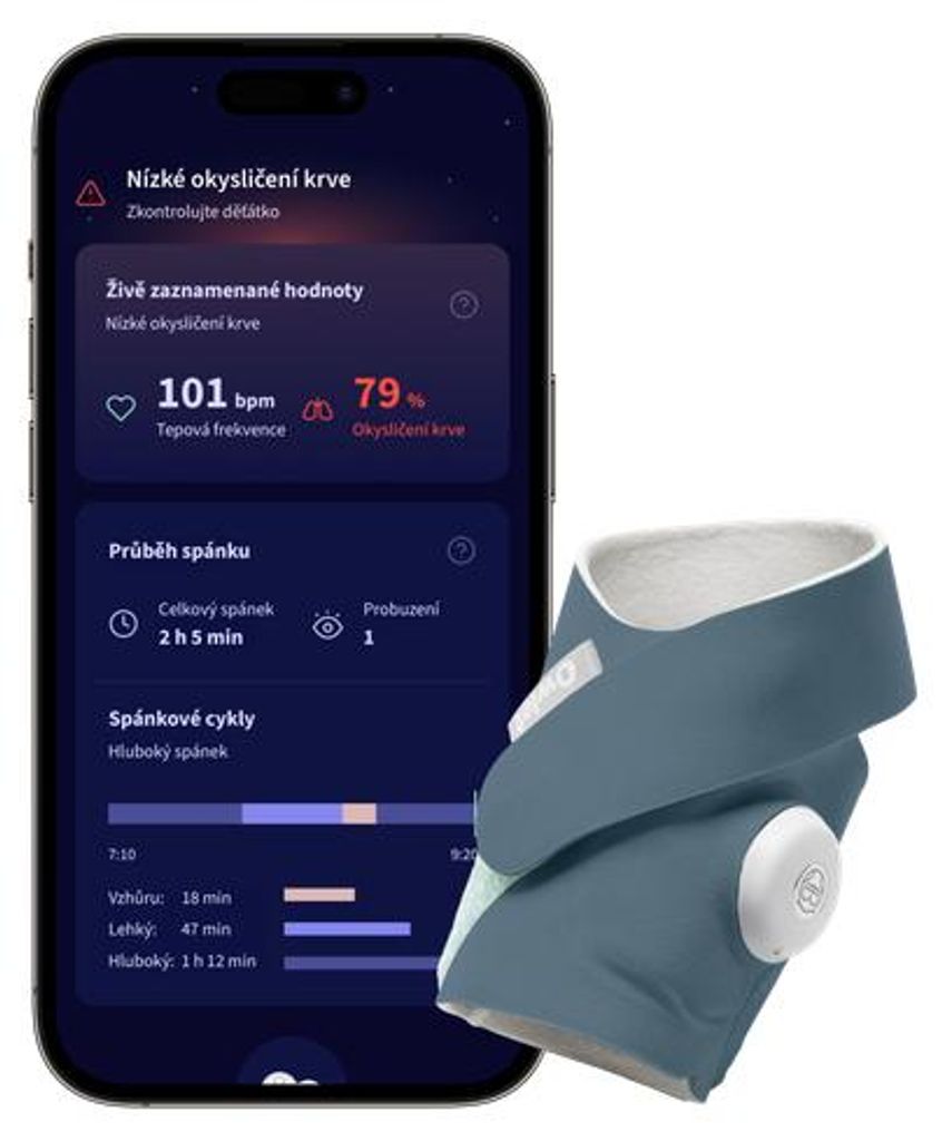 Owlet Dream Sock Pulsoksymetr monitor parametrów niemowlaka Zdjęcie produktu 