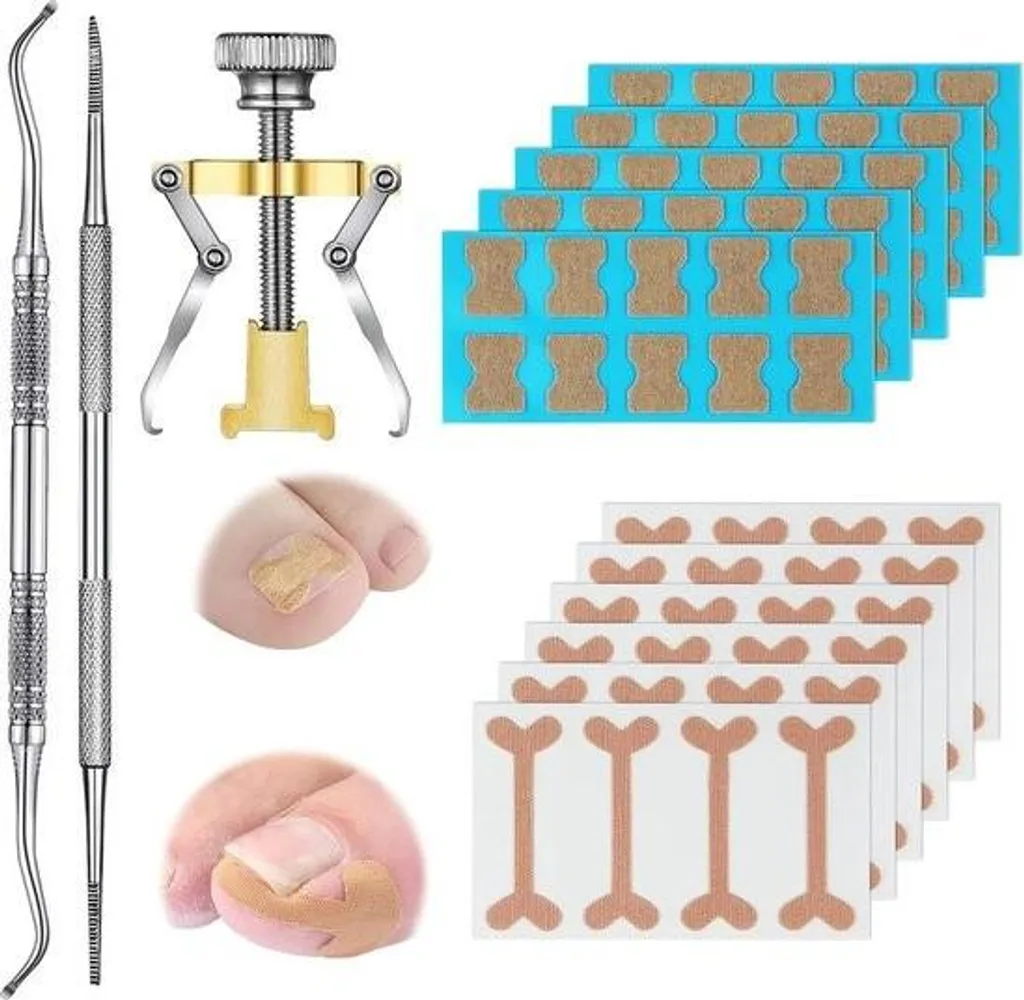 Kit traitement ongles incarnés avec correcteur incurvé et pansement