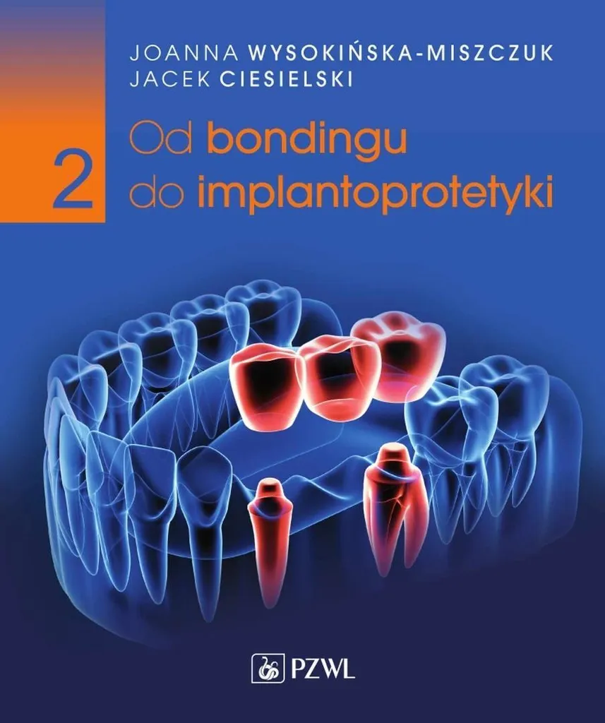 Perfectionnement en Implantologie : Livre Du Collage à la Prothèse Partie 2
