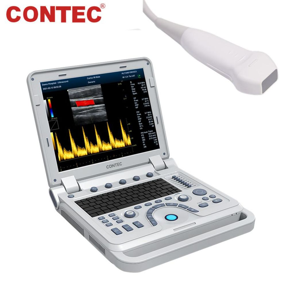 Farbdoppler-Ultraschall-Diagnosegerät mit hoher Auflösung Phased-Array-Sonde Kardiologie Tragbares Laptop-Gerät