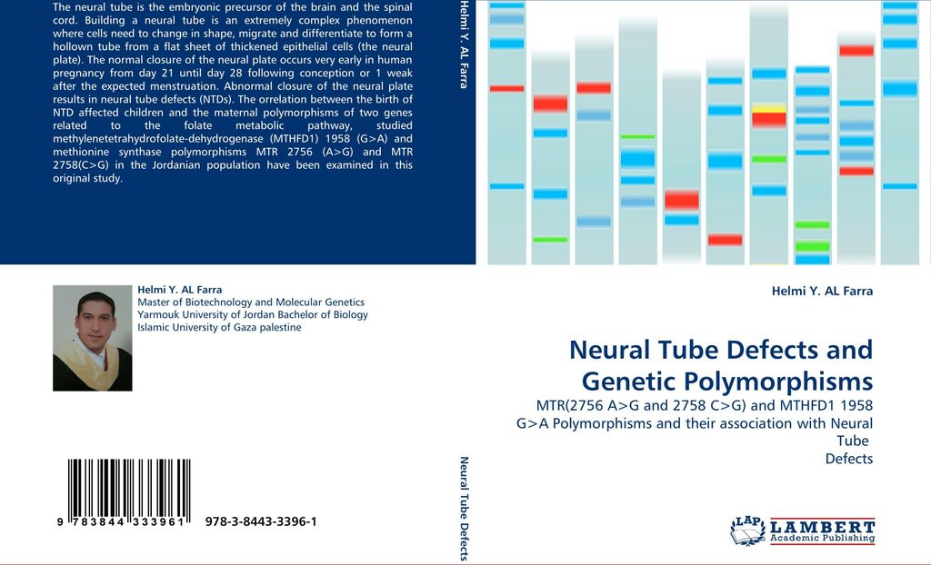 Neural Tube Defects and Genetic Polymorphisms