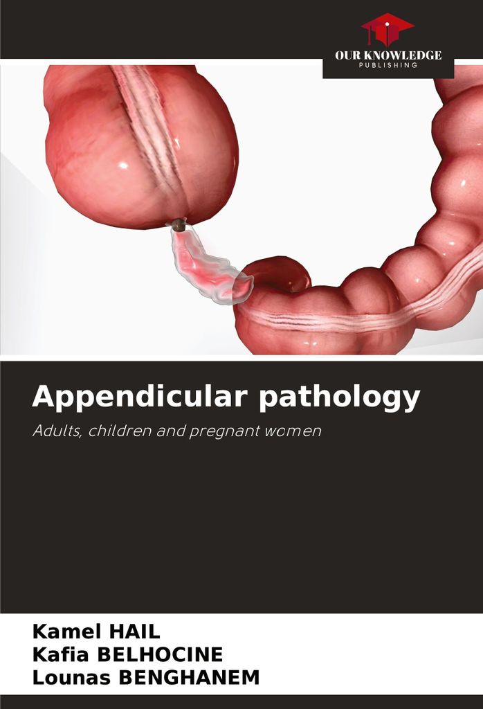 Appendicular pathology