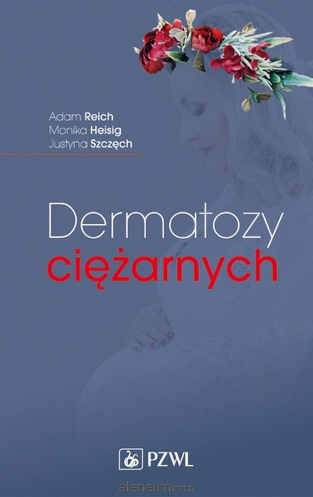 Dermatosen in der Schwangerschaft