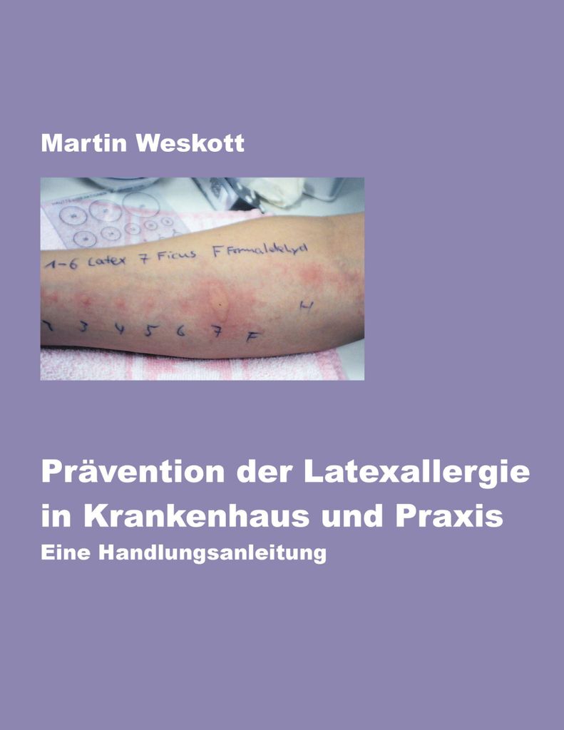 Pravention der Latexallergie in Krankenhaus und Praxis.by Weskott, Martin New.