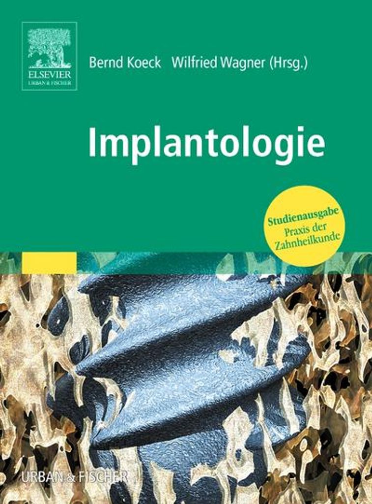 Praxis der Zahnheilkunde. Implantologie