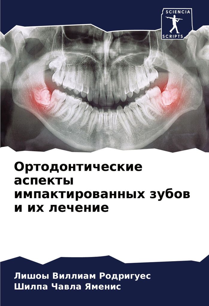 Ortodonticheskie aspekty impaktirowannyh zubow i ih lechenie