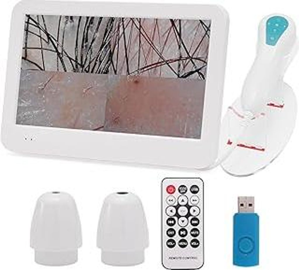 Hauthaaranalysator, 30,5 cm LCD Digitale Kopfhautanalysegerät, 50X 200X Tragbares wiederaufladbares Haarfollikelöl Feuchtigkeit Vergrößerungsde...