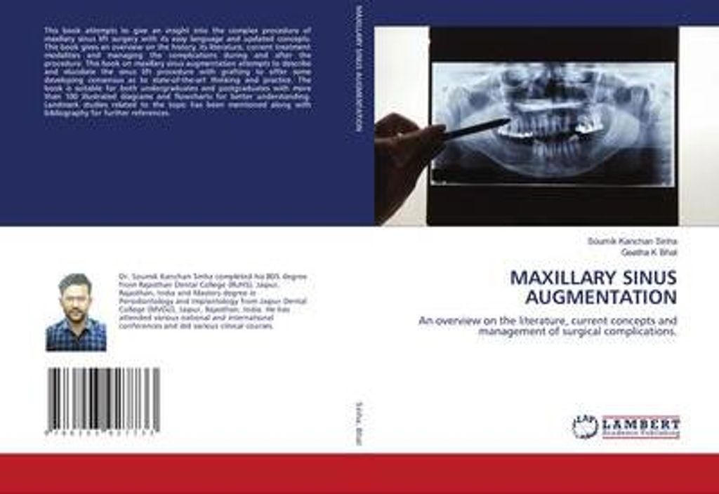Maxillary Sinus Augmentation