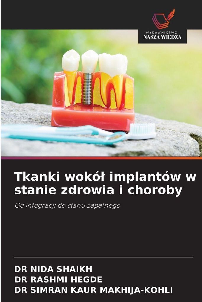 Tkanki wokó¿ implantów w stanie zdrowia i choroby