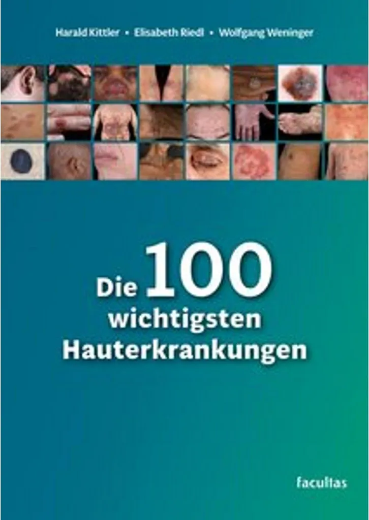 Livre d'Étude en Dermatologie : Diagnostiquer 100 Maladies de Peau