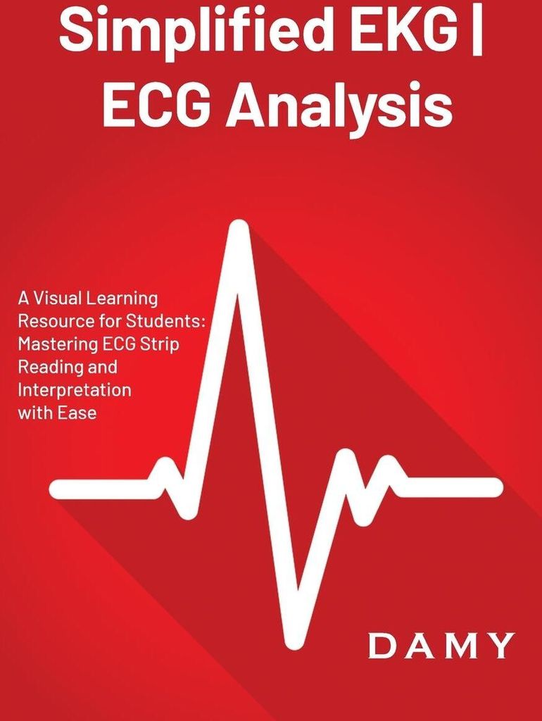 Simplified EKG | ECG Analysis